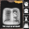 The Xray Of My Heart Cat Personalized Shirt