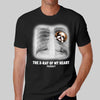 The X-ray Of My Heart Gift For Dog Lover Personalized Shirt